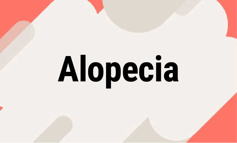 Alopecia Alopecia